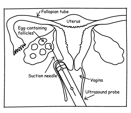 Egg collection diagram